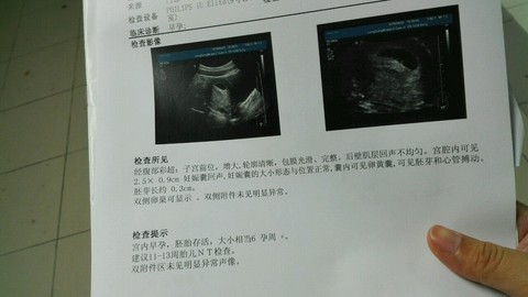journal_insert_pic_459139039
