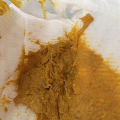 6个月宝宝这种大便干吗