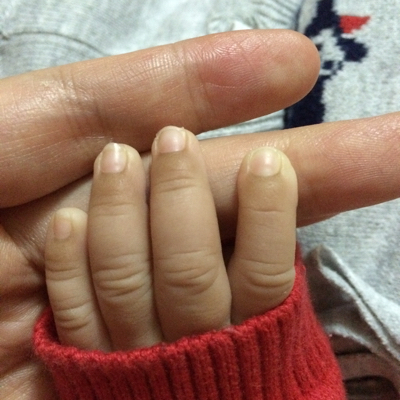 宝宝手指头颜色深什麼情况?