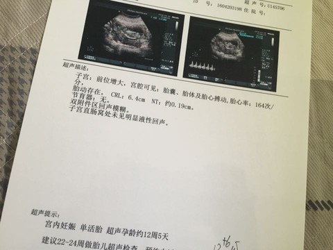 journal_insert_pic_462347918