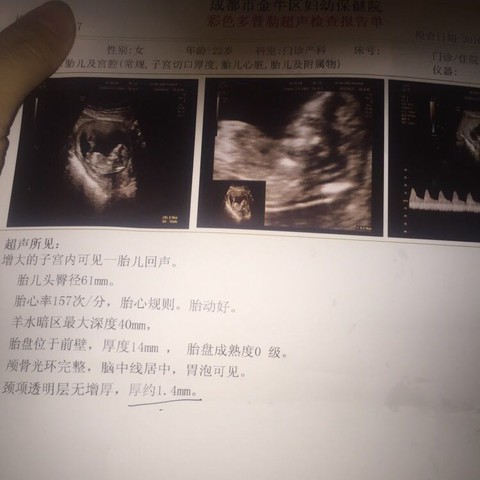journal_insert_pic_463457675