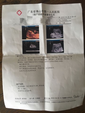 journal_insert_pic_463185967
