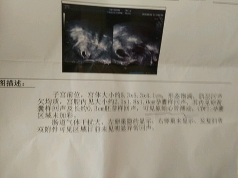 journal_insert_pic_463120175