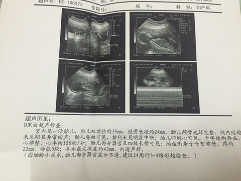 journal_insert_pic_463120283