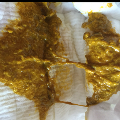 吃母乳,这样的粑粑正常吗?