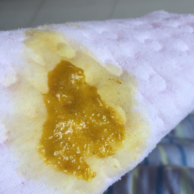 小宝宝大便不正常,一般是没吃饱,或者吃进去的吸收不了