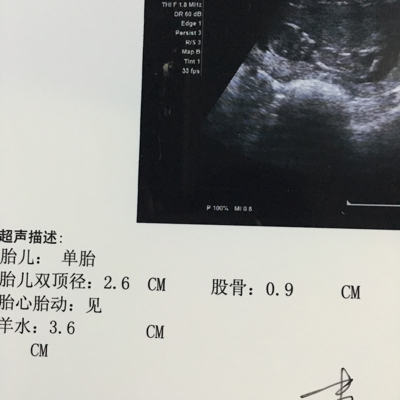 怀孕13周4天,从b超上可以看出男女吗?