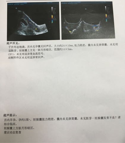 journal_insert_pic_467411422