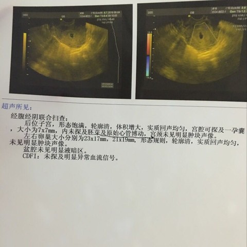 journal_insert_pic_469433214
