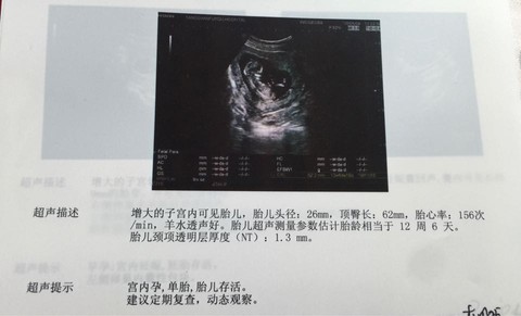 journal_insert_pic_469285338