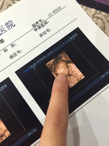 journal_insert_pic_469217619