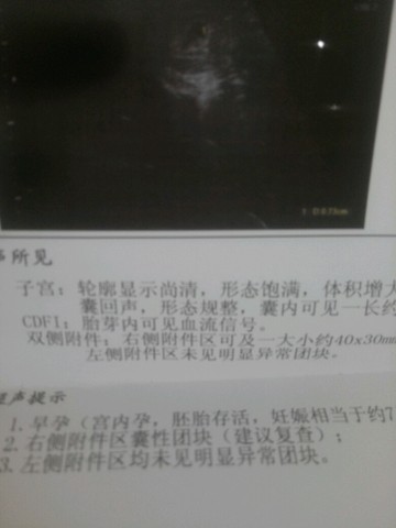 journal_insert_pic_470097462