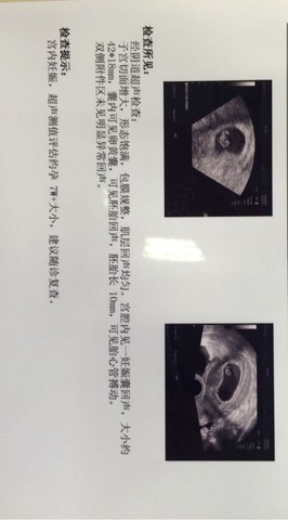 journal_insert_pic_469774169