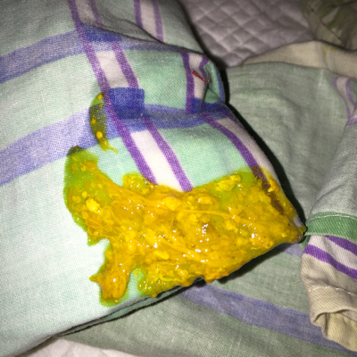 宝宝十八天了,大便是这样的,正常吗?