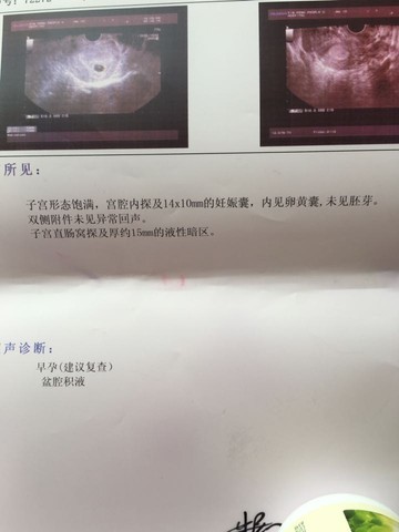 journal_insert_pic_472640381
