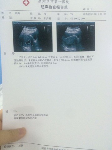 journal_insert_pic_472462368