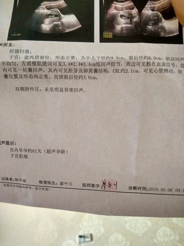 journal_insert_pic_472603901