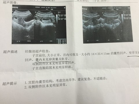 journal_insert_pic_473035480