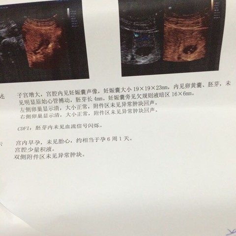 journal_insert_pic_472985852