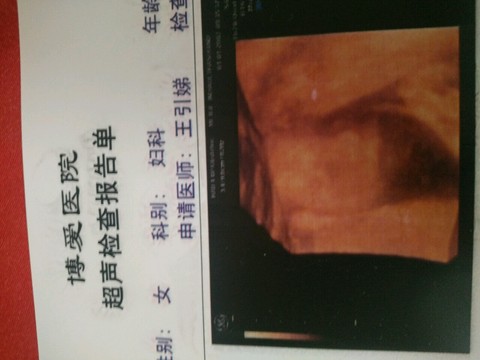 journal_insert_pic_472984961