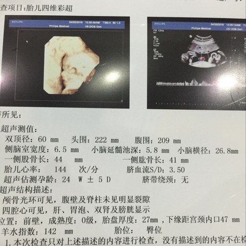 journal_insert_pic_473788983