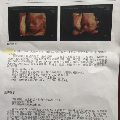 journal_insert_pic_473420772