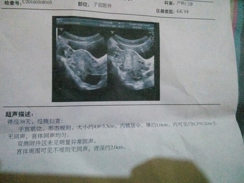 journal_insert_pic_475684977