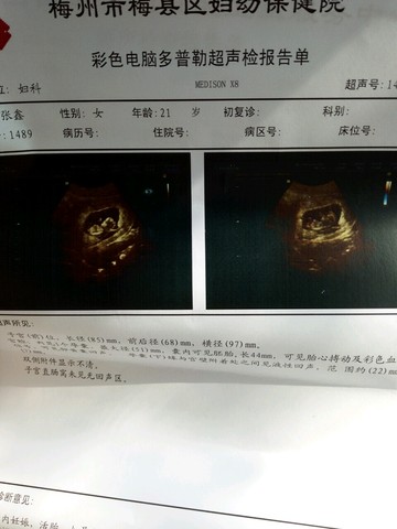 journal_insert_pic_475308945
