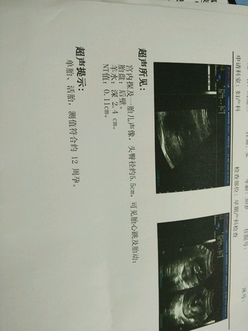 journal_insert_pic_476236423