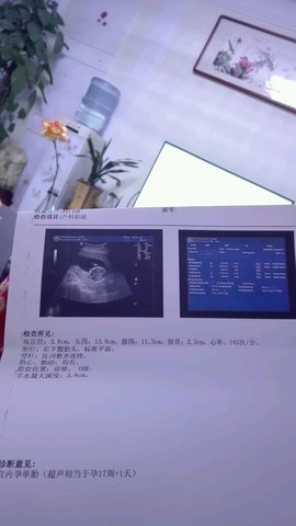 journal_insert_pic_476841302