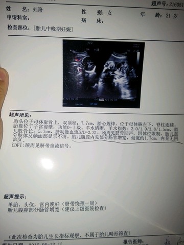 journal_insert_pic_477609792