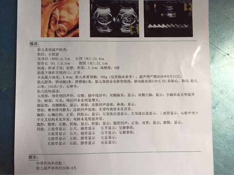 journal_insert_pic_478582624