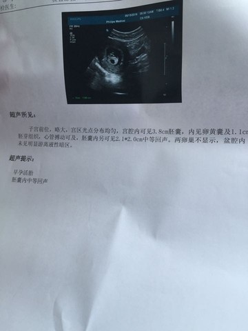 journal_insert_pic_479038509
