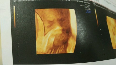journal_insert_pic_480394759