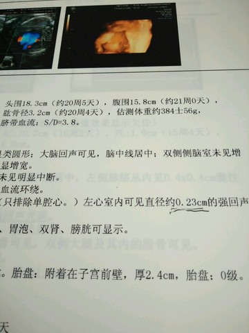 journal_insert_pic_479993462