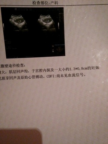 journal_insert_pic_480158167