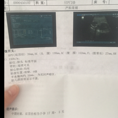 journal_insert_pic_481723549