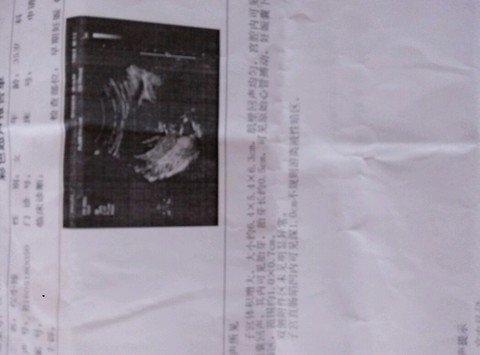 journal_insert_pic_481740792