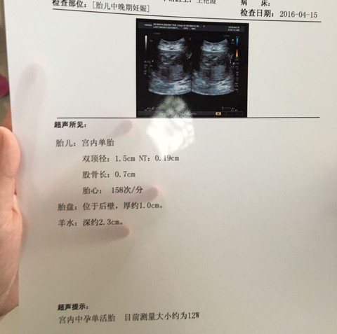 journal_insert_pic_482983630