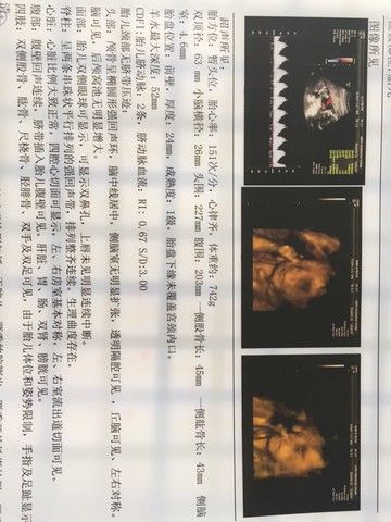 journal_insert_pic_482529564