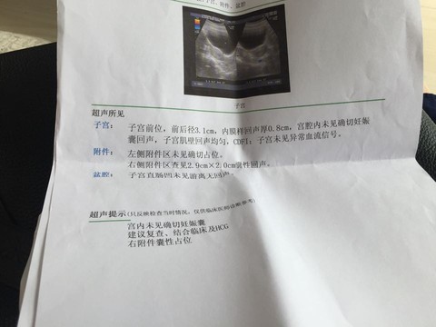 journal_insert_pic_483774025