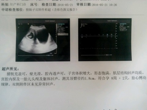 journal_insert_pic_484708582