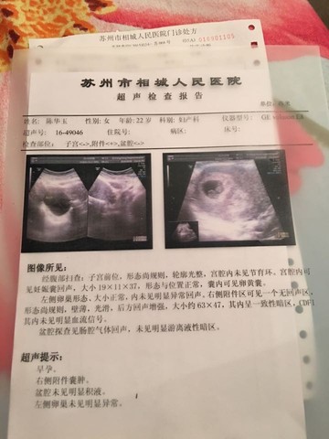 journal_insert_pic_486754434