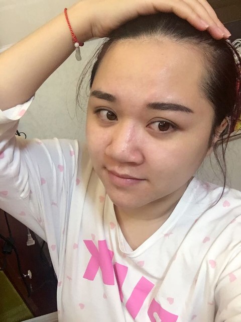 皮肤好黄
