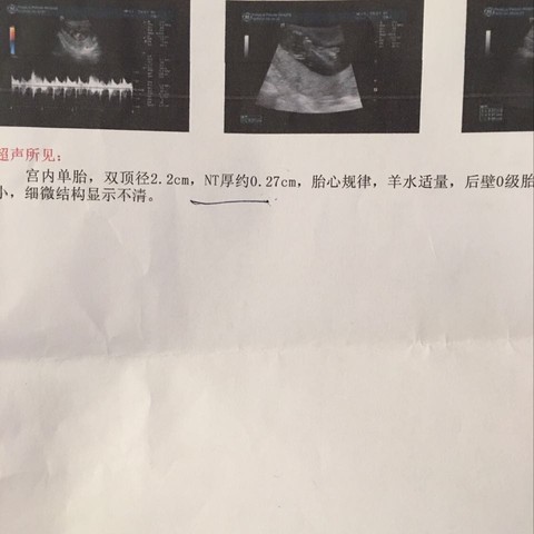 journal_insert_pic_489388923