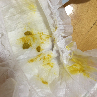 宝宝出生14天,最近大便困难,可以用开塞露吗