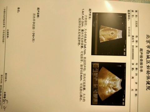 journal_insert_pic_493305049