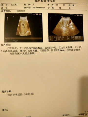 journal_insert_pic_493305383