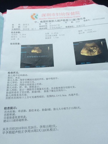 journal_insert_pic_495014531