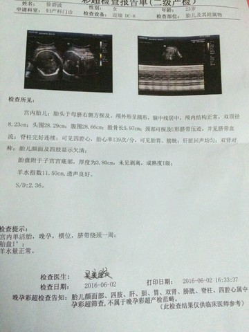 journal_insert_pic_496231003